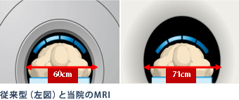 従来型（左図）と当院のMRI